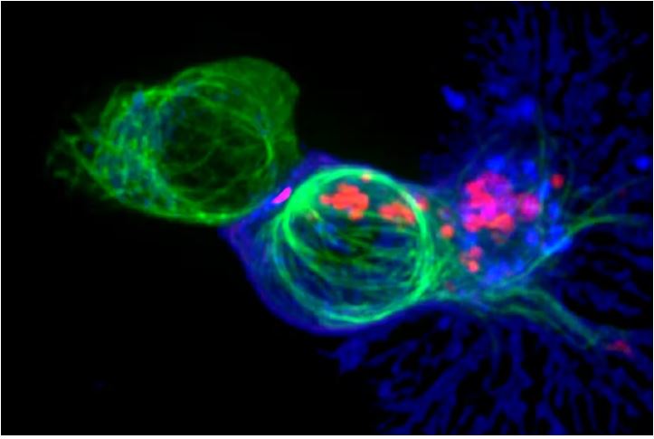 تصویر میکروسکوپی از حمله سلول T به سلول سرطانی